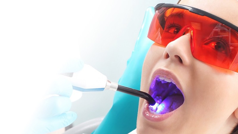Лазерное отбеливание зубов Томск Кузнецкий мюнниха 17 стоматология томск телефон детская